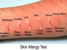 allergy-test-common-environmental-allergies-02